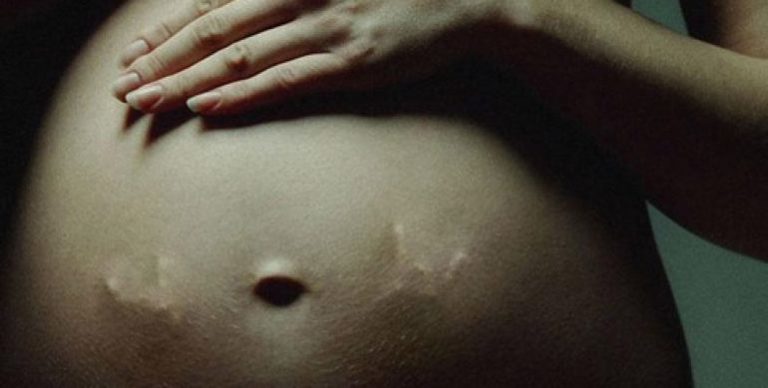 ➤ 36 неделя беременности всё что нужно знать будущей маме