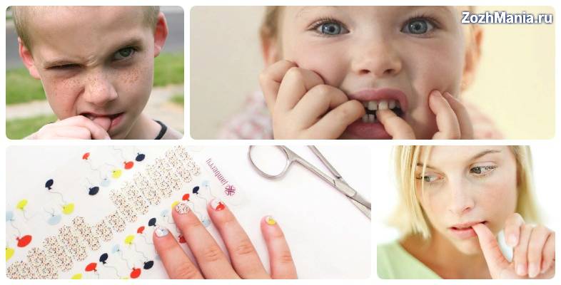 Эффективные способы как отучить ребенка грызть ногти