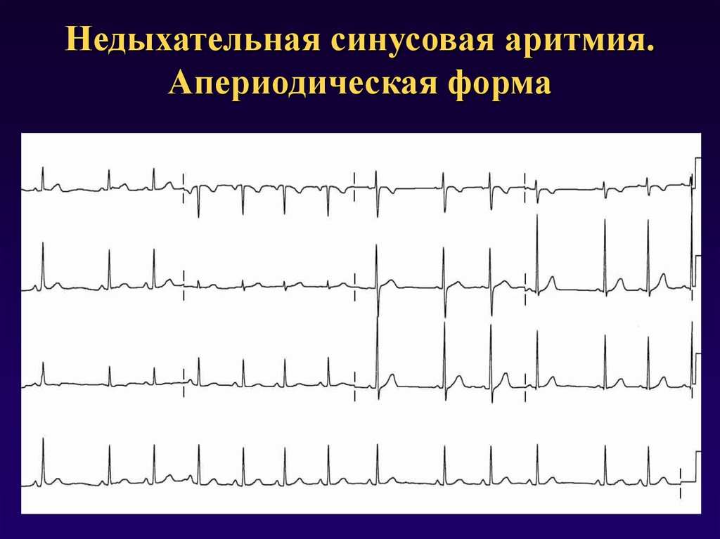 Детский кардиолог в новосибирске | цены, отзывы, врачи, записаться на консультацию в «сердолик»