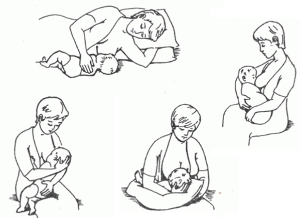 Как правильно прикладывать ребенка для кормления. позы для грудничка, правильное прикладывание к груди - поликлиника №8 город владивосток