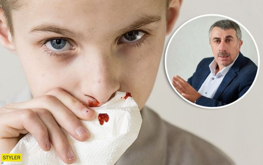Частые кровотечения из носа: в чем причины и что делать? | москва