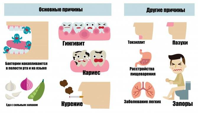 Выделения с запахом у женщин