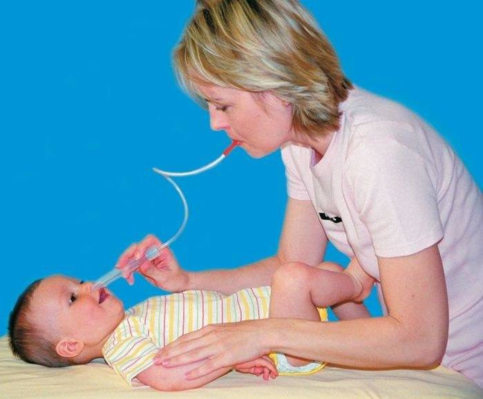 Сопли у ребенка - как быстро вылечить и когда вызывать врача - мамэксперт