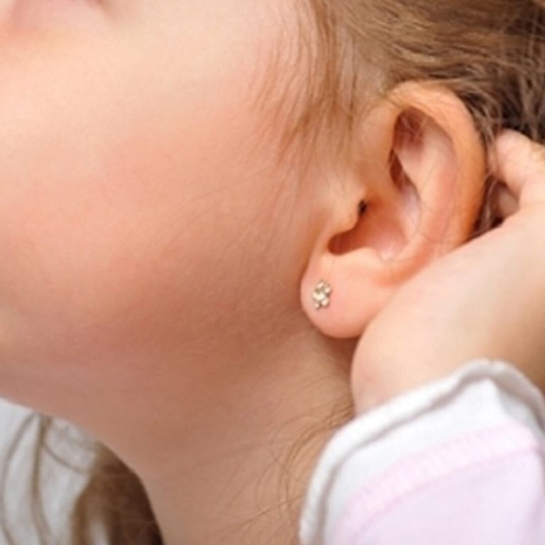 Медики не рекомендуют прокалывать уши до 15 лет: как правильно делать проколы, какой металл использовать