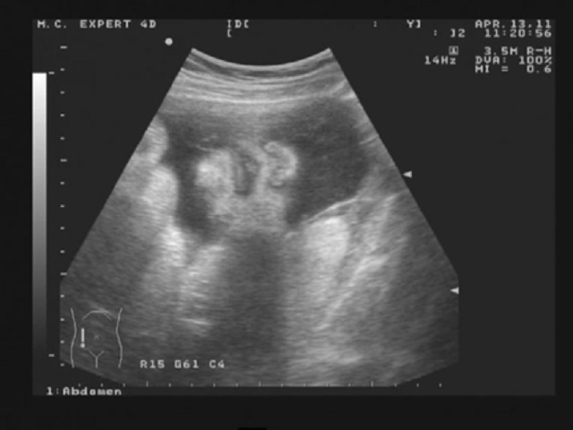 34 неделя беременности: малыш продолжает готовиться к рождению