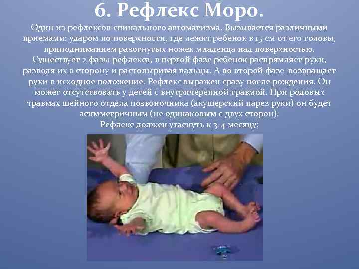 Рефлекс Моро у новорожденных: границы нормы и патологии