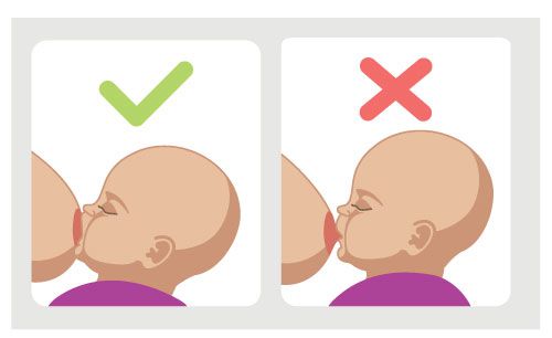 Как избавиться от трещин на сосках: подарите себе и малышу спокойные кормления