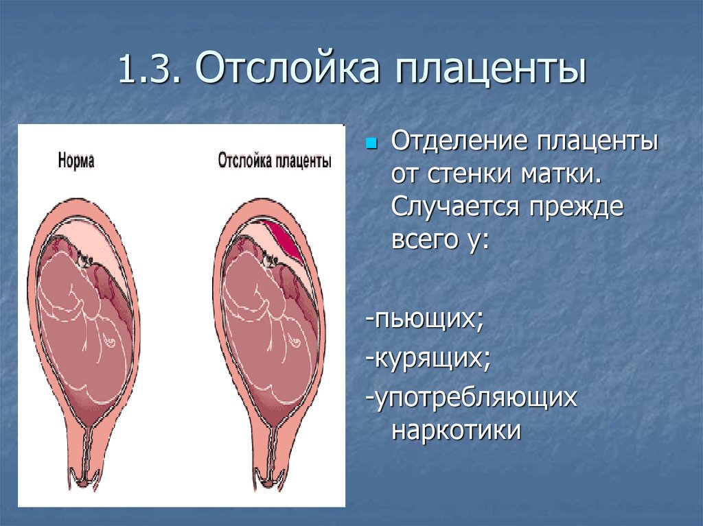 Отслойка плаценты — причины, симптомы, лечение в иркутске — medcenter.online