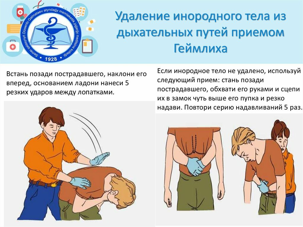 Что делать, если ребенок подавился?