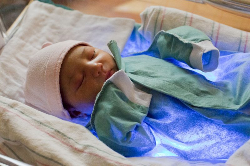 Чем опасна желтушка у новорожденных? причины и возможные последствия, лечение