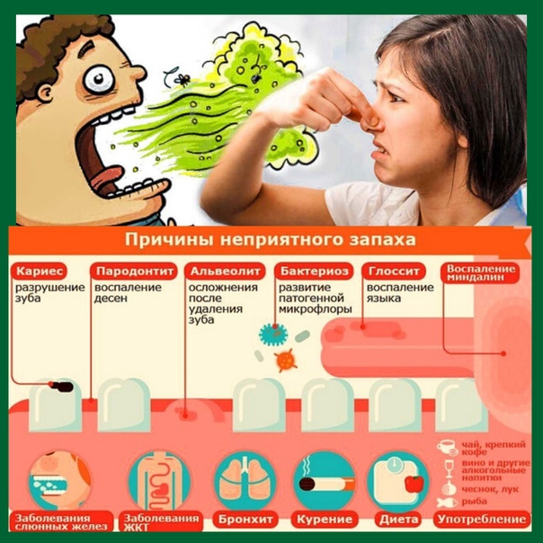Почему изо рта пахнет ацетоном ? | причины неприятного запаха ацетона изо рта