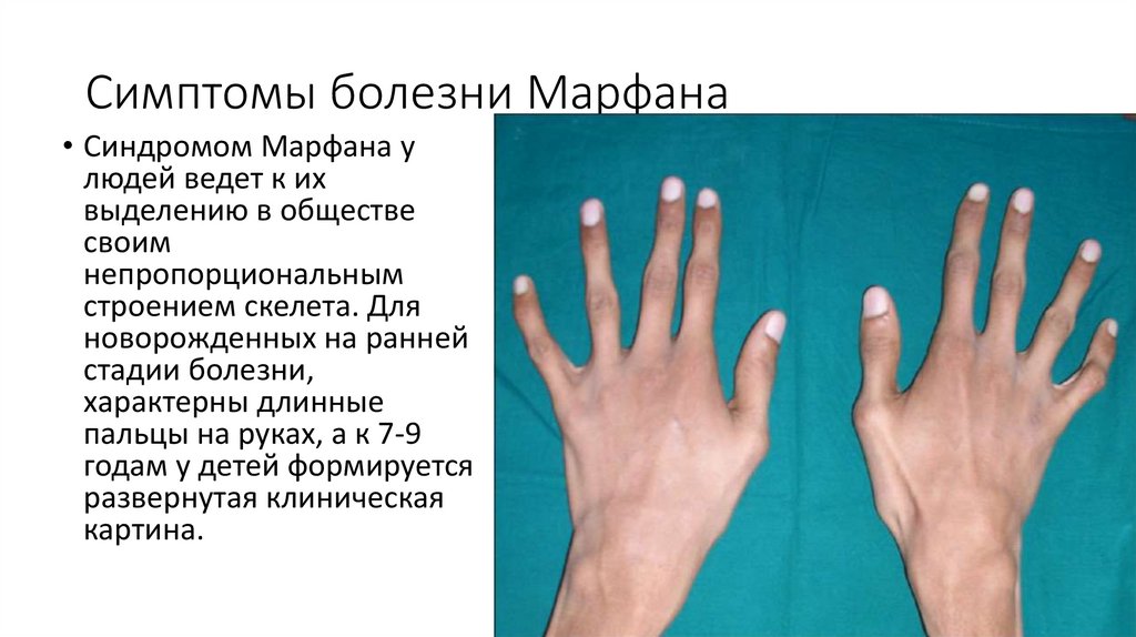 Дисплазия соединительной ткани в практике врача-педиатра » библиотека врача