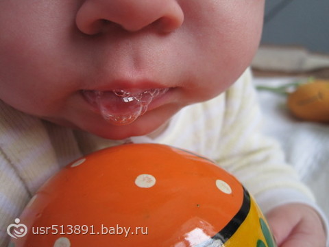 Молочница у детей (+ фото)