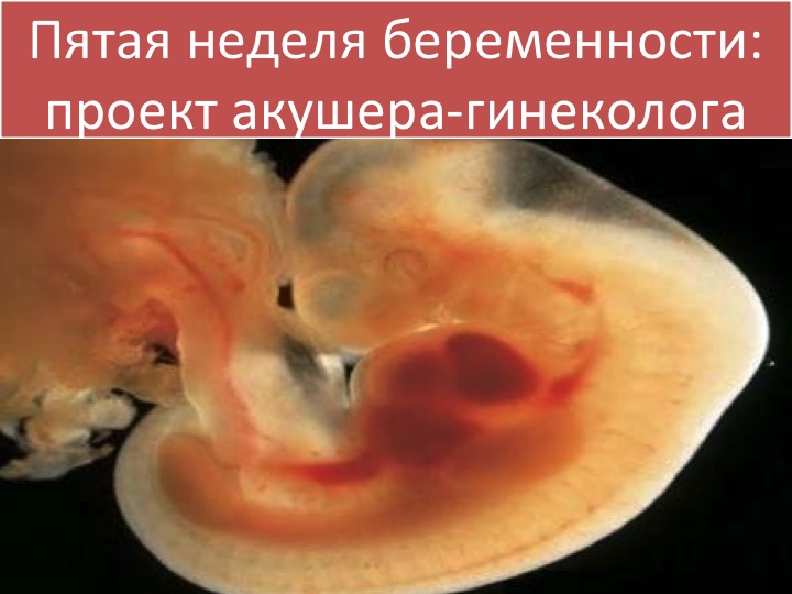 Беременность 5 недель фото. Эмбрион на 5 неделе беременности. Ребёнок на 5 неделе беременности.
