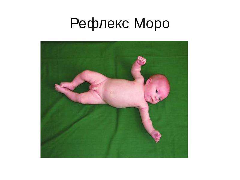 Рефлекс моро фото