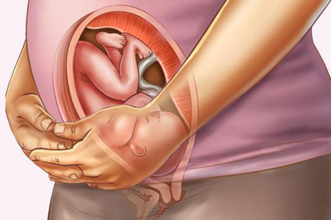 30 неделя беременности: признаки и ощущения женщины, симптомы, развитие плода
