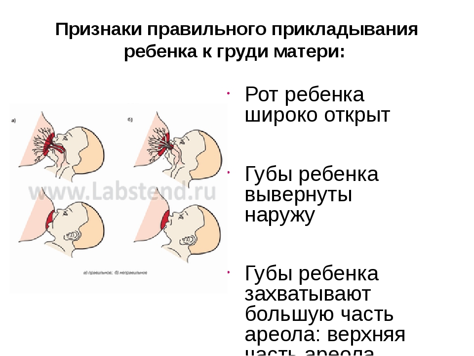 Боль в придатках у женщин | университетская клиника