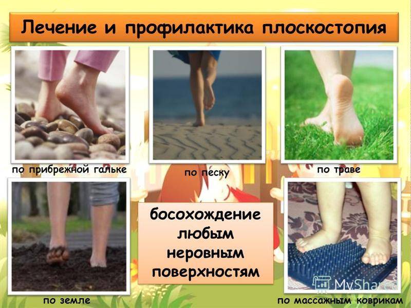 Профилактика плоскостопия у детей в доо — физинструктор.ру