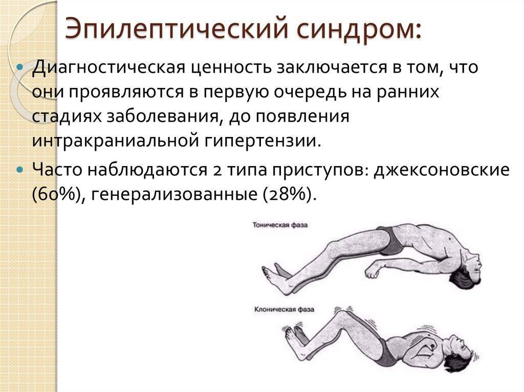 Судороги картинки для презентации