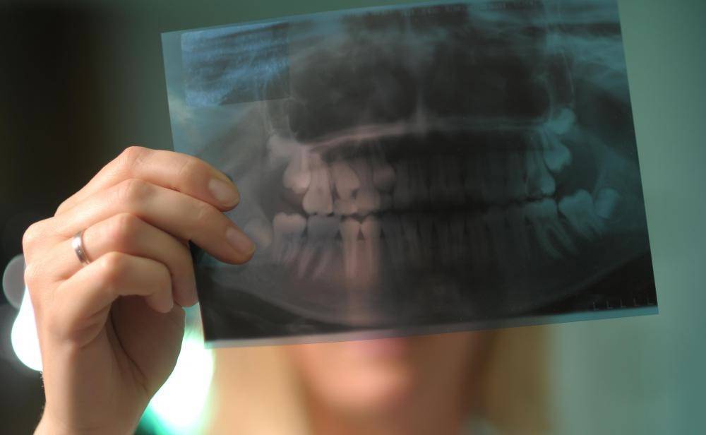 Можно ли делать рентген зуба при беременности?