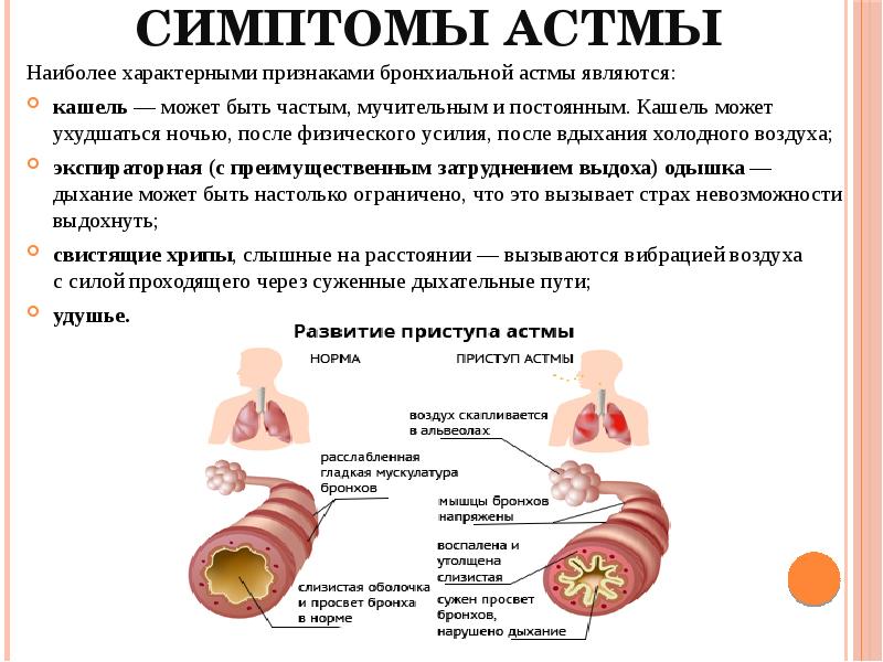 Бронхиальная астма - воспаление бронхов.