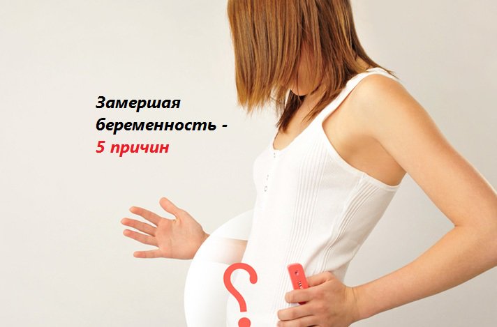 Замершая беременность - причины, сроки, признаки замершей беременности