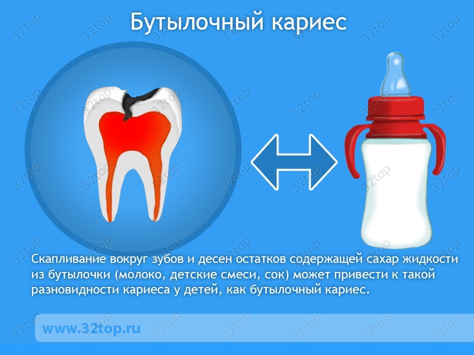 Профессиональная чистка зубов - фото до и после профессиональной гигиены полости рта