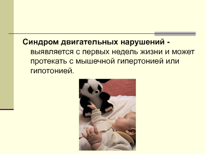 Синдром двигательных нарушений (сдн) ~ факультетские клиники иркутского государственного медицинского университета