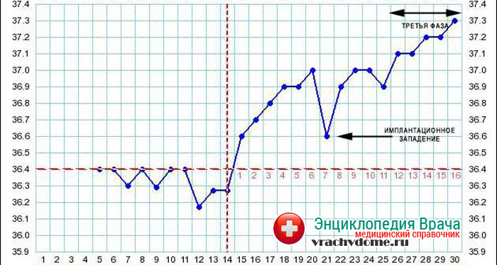 Температура на первой неделе беременности. График БТ С имплантационным западением. График базальной температуры с имплантационным западением. БТ имплантационное западение на графике БТ. Западение на графике базальной температуры.