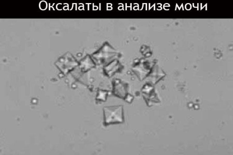 Причины появления крови в моче