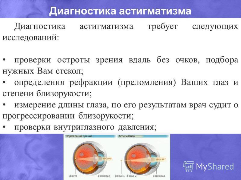 Проверить астигматизм картинки