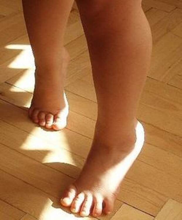 Почему ребенок ходит на носочках. причины - доктор позвонков
