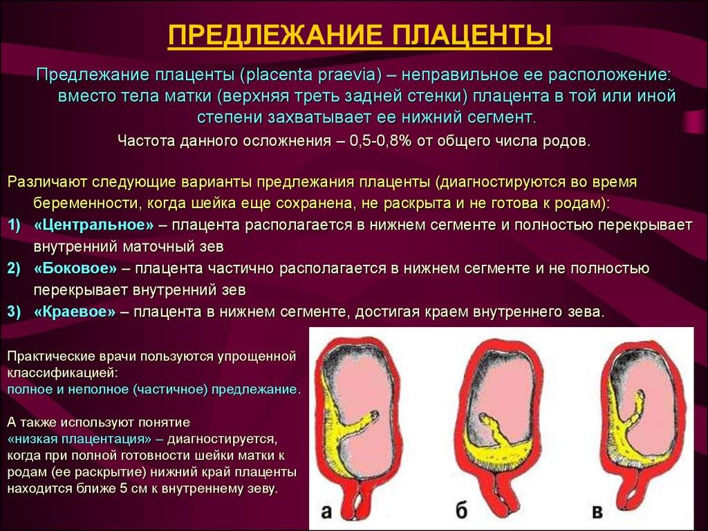 Аномалии развития плаценты презентация