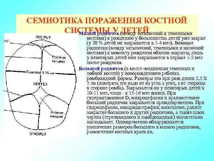 Маленький родничок у новорожденного