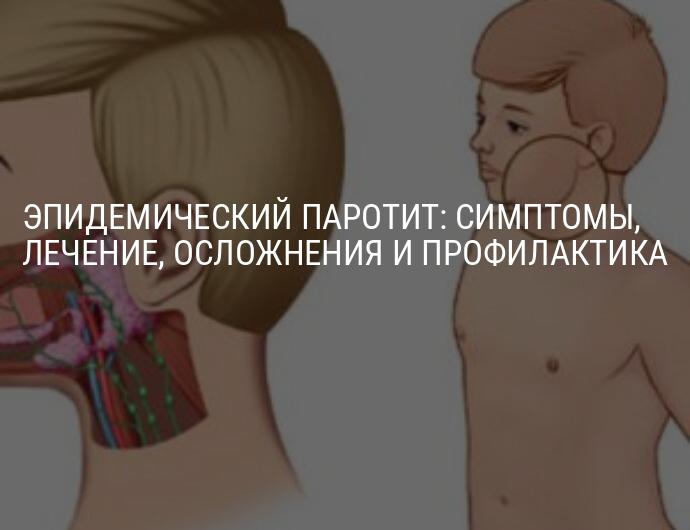 Паротит