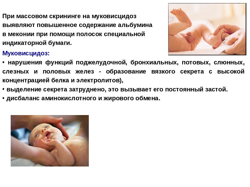 Какие анализы берут в роддоме для скрининга новорожденных на наследственные заболевания