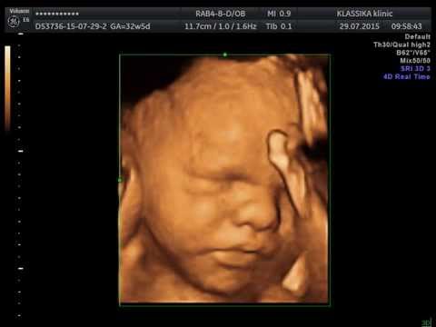 32 недель беременности: развитие плода, норма веса ребенка. узи, кгт, ощущения женщины