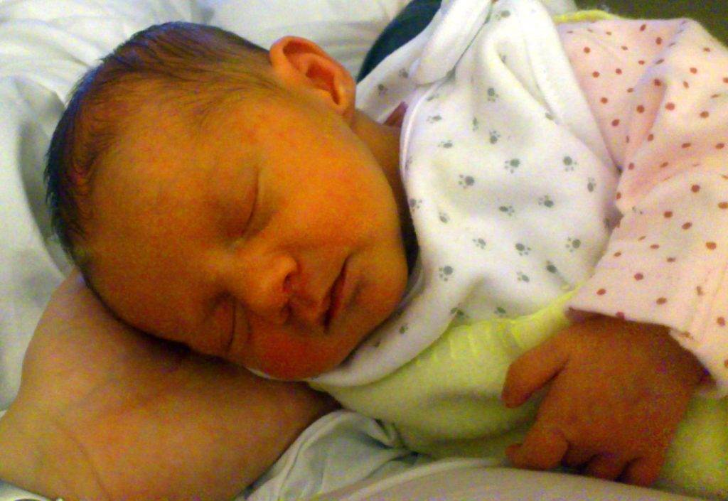 Особенности сестринской деятельности при пограничных состояниях новорожденных: желтуха новорожденных
