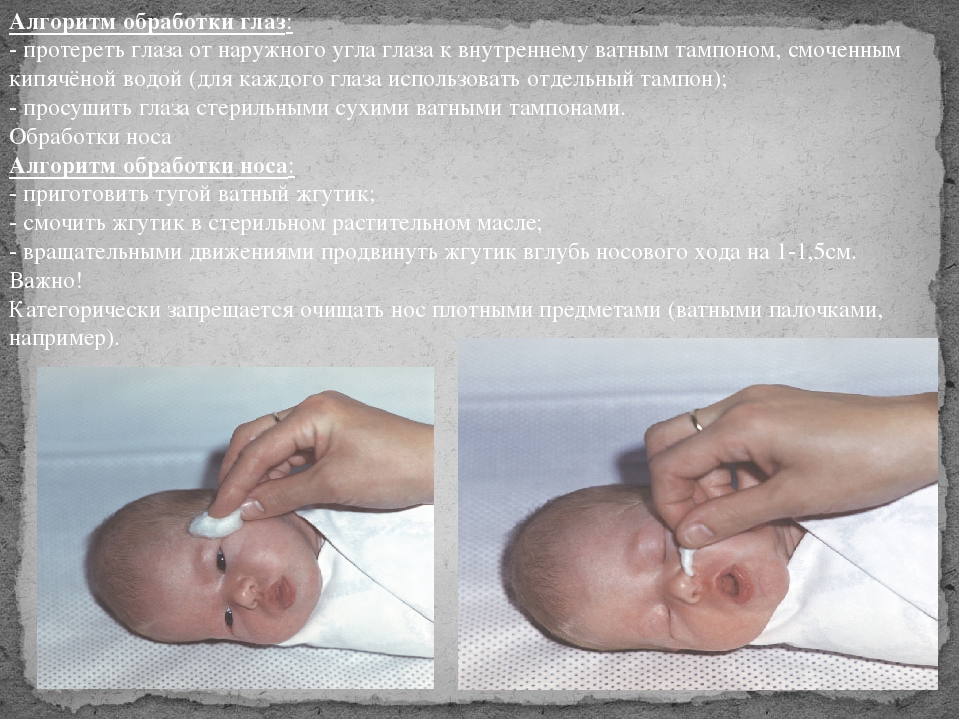 Проведение утреннего туалета новорожденному ребенку. Обработка глаз новорожденного алгоритм. Утренний туалет новорожденного ребенка. Обработка глаз новорожденного туалет.