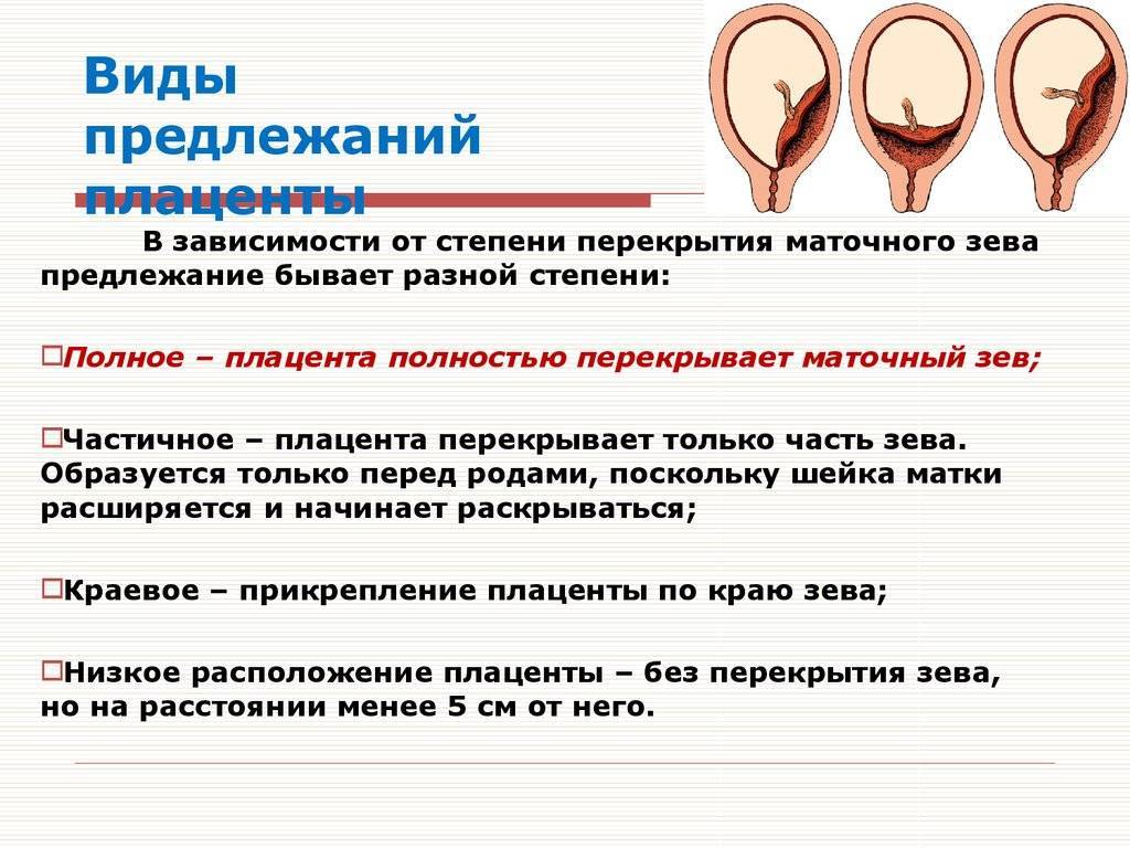 Предлежание плаценты при беременности: причины, симптомы, диагностика и лечение