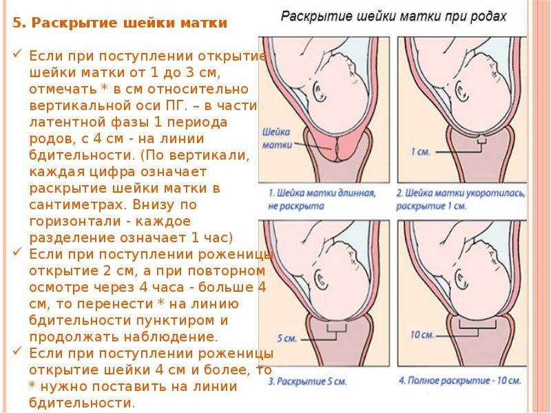 Подготовка шейки матки к родам и родовозбуждение