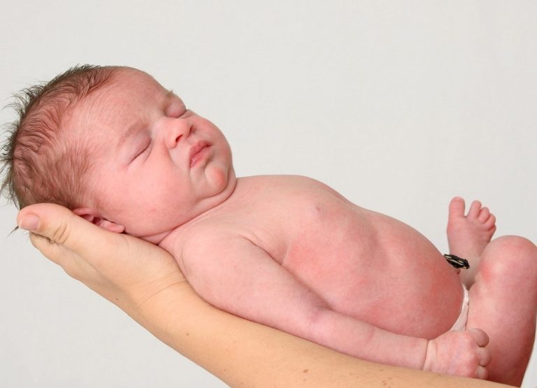 Правильный алгоритм ухода за пупочной ранкой новорожденного и чем лучше мазать