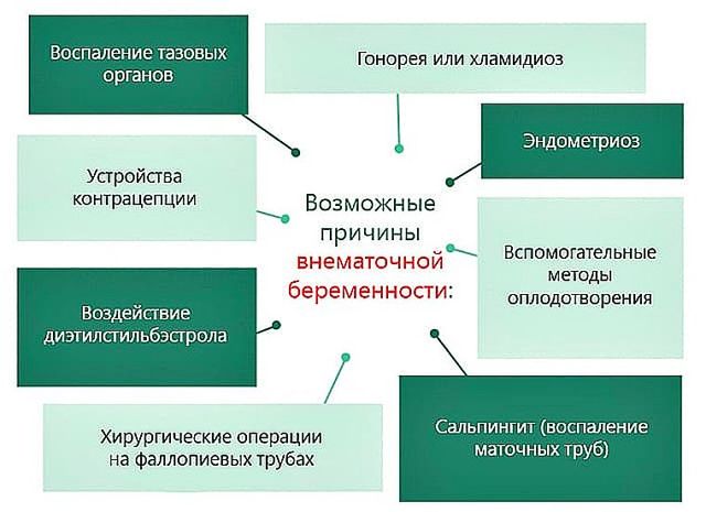 Какие симптомы при внематочной беременности