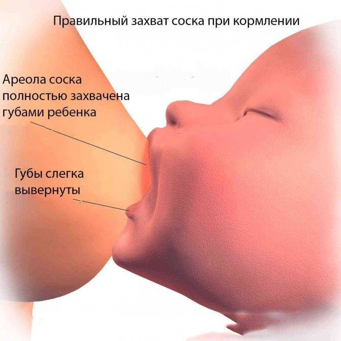 Мышечно-тонический синдром - лечение, симптомы, причины, диагностика | центр дикуля