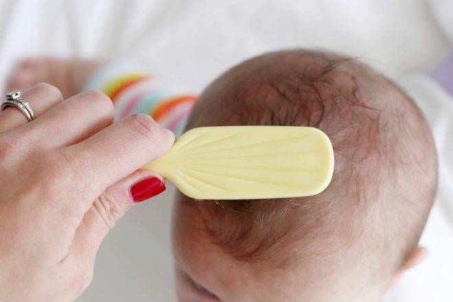 Молочные корочки: как ухаживать за кожей головы новорожденного - parents.ru