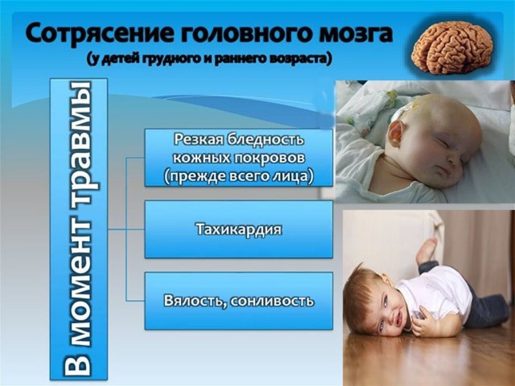 Сотрясение головного мозга у детей. признаки сотрясения мозга у ребенка до года