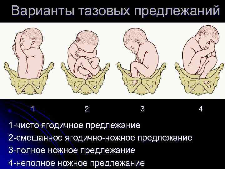 Положение плода продольное предлежит головка