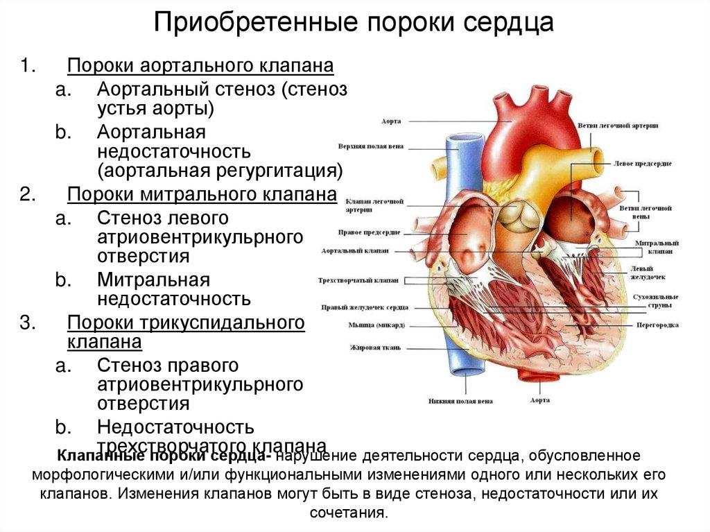 Врожденные пороки сердца. причины и лечение