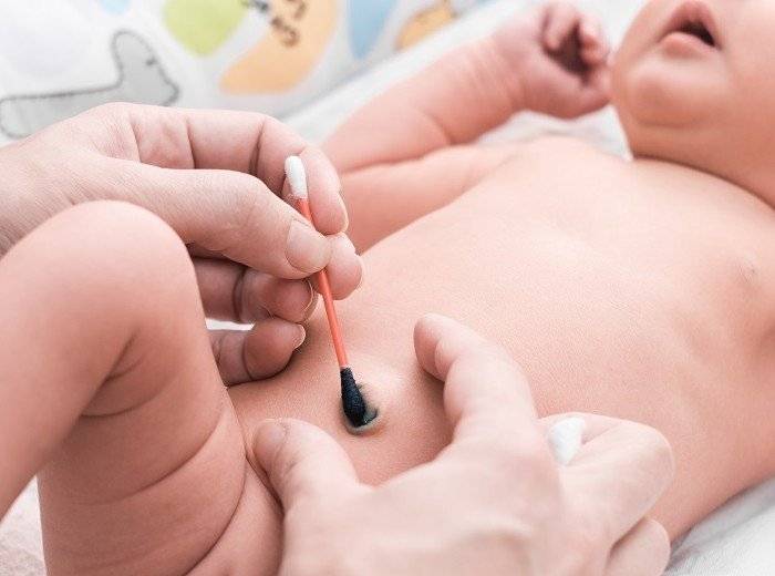 Правильный алгоритм ухода за пупочной ранкой новорожденного и чем лучше мазать