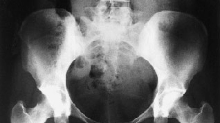 Рентген и кт в стоматологии – вредно или безопасно? - блог денталюкс